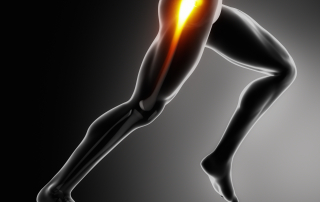 Runner with glute medius dysfunction