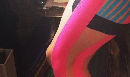 kinesiotape
